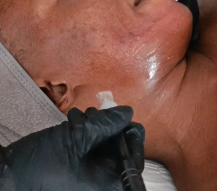 Dar Nour: Nettoyage de peau