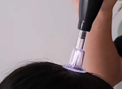 Dar Nour : Plasma Lift Capillaire